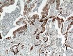 JP45/JSRP1 Antibody in Immunohistochemistry (Paraffin) (IHC (P))