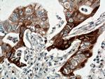 JP45/JSRP1 Antibody in Immunohistochemistry (Paraffin) (IHC (P))