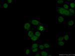 Histone H2A.X Antibody in Immunocytochemistry (ICC/IF)