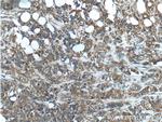 PKC zeta Antibody in Immunohistochemistry (Paraffin) (IHC (P))