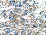 PKC zeta Antibody in Immunohistochemistry (Paraffin) (IHC (P))