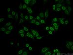 MECP2 Antibody in Immunocytochemistry (ICC/IF)