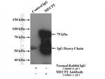 MECP2 Antibody in Immunoprecipitation (IP)