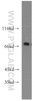 MECP2 Antibody in Western Blot (WB)