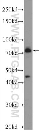 MECP2 Antibody in Western Blot (WB)