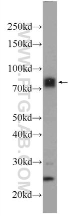 MECP2 Antibody in Western Blot (WB)