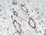 Endoglin/CD105 Antibody in Immunohistochemistry (Paraffin) (IHC (P))