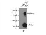 Endoglin/CD105 Antibody in Immunoprecipitation (IP)