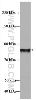 Endoglin/CD105 Antibody in Western Blot (WB)