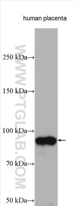 Endoglin/CD105 Antibody in Western Blot (WB)