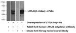 LYPLA3 Antibody in Western Blot (WB)