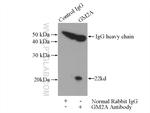 GM2A Antibody in Immunoprecipitation (IP)