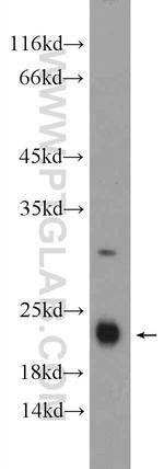 GM2A Antibody in Western Blot (WB)