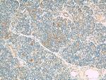 VDAC1/2 Antibody in Immunohistochemistry (Paraffin) (IHC (P))