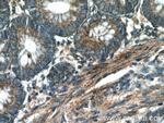 VDAC1/2 Antibody in Immunohistochemistry (Paraffin) (IHC (P))