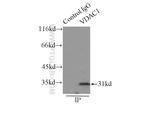 VDAC1/2 Antibody in Immunoprecipitation (IP)