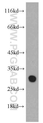 VDAC1/2 Antibody in Western Blot (WB)