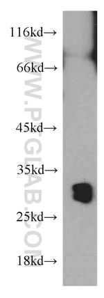 VDAC1/2 Antibody in Western Blot (WB)