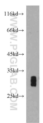 VDAC1/2 Antibody in Western Blot (WB)