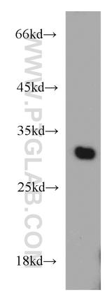 VDAC1/2 Antibody in Western Blot (WB)