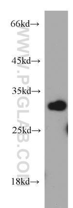 VDAC1/2 Antibody in Western Blot (WB)