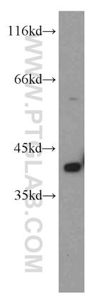 PITX1 Antibody in Western Blot (WB)