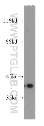 PITX1 Antibody in Western Blot (WB)