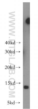 LSM10 Antibody in Western Blot (WB)