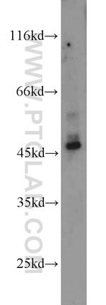 HSP47 Antibody in Western Blot (WB)