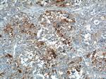 PRELID1 Antibody in Immunohistochemistry (Paraffin) (IHC (P))