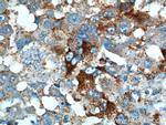 PRELID1 Antibody in Immunohistochemistry (Paraffin) (IHC (P))