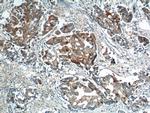 PRELID1 Antibody in Immunohistochemistry (Paraffin) (IHC (P))