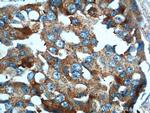 PRELID1 Antibody in Immunohistochemistry (Paraffin) (IHC (P))