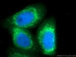 PTGES2 Antibody in Immunocytochemistry (ICC/IF)