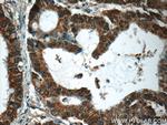 PTGES2 Antibody in Immunohistochemistry (Paraffin) (IHC (P))