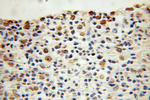 P16-INK4A Antibody in Immunohistochemistry (Paraffin) (IHC (P))