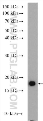 P16-INK4A Antibody in Western Blot (WB)