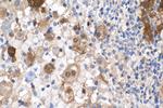 P16-INK4A Antibody in Immunohistochemistry (Paraffin) (IHC (P))