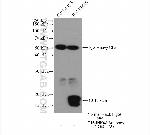 P16-INK4A Antibody in Immunoprecipitation (IP)