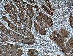 P16-INK4A Antibody in Immunohistochemistry (Paraffin) (IHC (P))