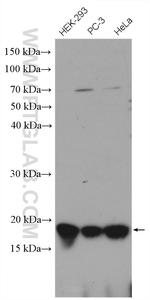 P16-INK4A Antibody in Western Blot (WB)