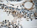 ETF1 Antibody in Immunohistochemistry (Paraffin) (IHC (P))