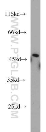 ETF1 Antibody in Western Blot (WB)