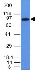 MALT1 (MALT-Lymphoma Marker) Antibody in Western Blot (WB)