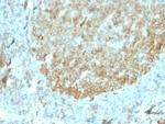 MALT1 Antibody in Immunohistochemistry (Paraffin) (IHC (P))