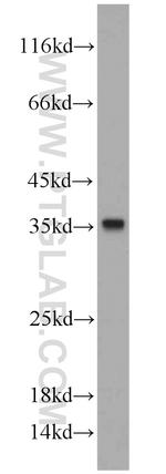 CYB5R3 Antibody in Western Blot (WB)