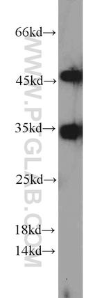 CYB5R3 Antibody in Western Blot (WB)