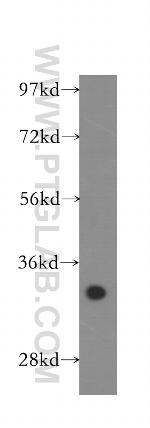 CYB5R3 Antibody in Western Blot (WB)