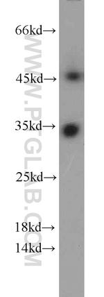 CYB5R3 Antibody in Western Blot (WB)