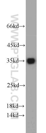 CYB5R3 Antibody in Western Blot (WB)